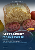Reverse Your Fatty Liver - Unions Health Vital Info Guide